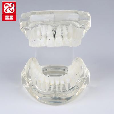 China Hospital Clinic University Orthodontic Dental Model With Ceramic Brackets for sale