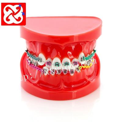 China Vivid orthodontic treatment demonstration model extracted premolar with brackets, ligature wire affixed for sale