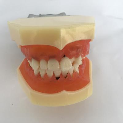 China Vivid Severely Inflamed Gums DP Periodontal Dental Model Articulator for sale