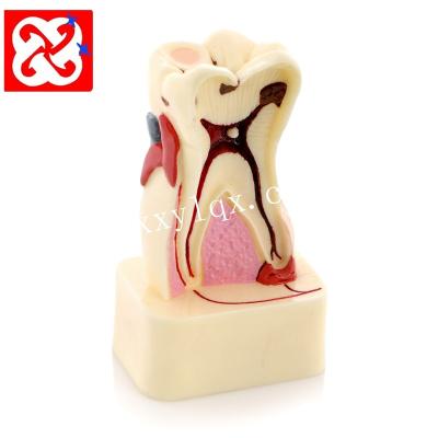 China Detailed Anatomy Structures 4 Periods Dental Anatomy Pathologies Single Tooth Model for sale