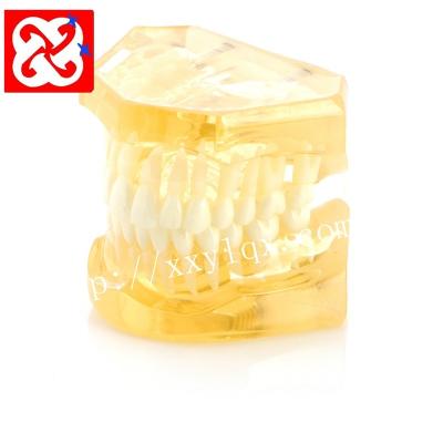 China Human Simulation Realistic Transparent Standard Teeth Orthodontic Model for Orthodontic Demonstration and Practice Standard Dental Model for sale