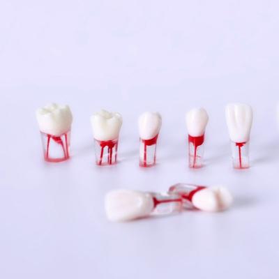 China Detailed Anatomy Structures Block Endo Dental Root Pulp Cavity Formation Root Canal Model Endodontic Model for sale