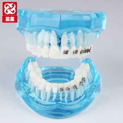 China Dental Anatomy Model Dental Model With Metal /demonstration Orthodontic Model And Ceramic Bracket for sale