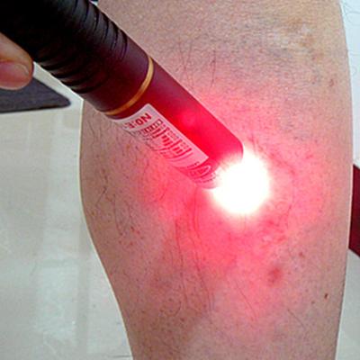 China Reliable Body Safety Analgeia Anti-inflammatory Wound Healing Eliminate Edema Facial Neuralgia Laser Treatment Laser Therapy for sale