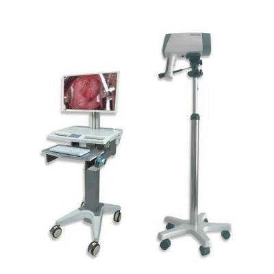 China Metal Gynecological Examination Equipment Digital Video Colposcope zu verkaufen