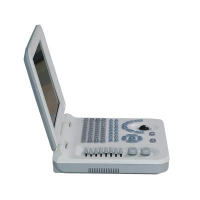 China Economical Diagnostic Notebook Ultrasound Scanner With Battery Full Digital Ultrasound System for sale