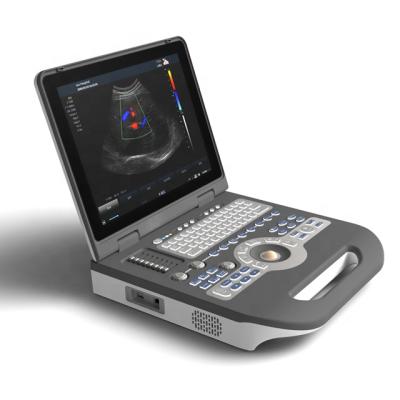 China Laptop 4D Echo Ultrasound Scanner Color Doppler Diagnostic for sale