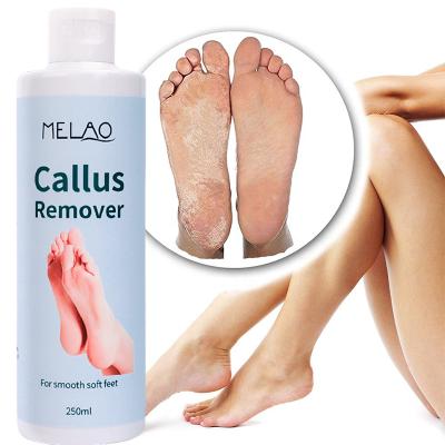 China Remove Thick Custom Soft Soft Feet Of Horny Layers Gel To Exfoliate Moisturize Dead Skin Remove Callus Remover Gel The Foot for sale