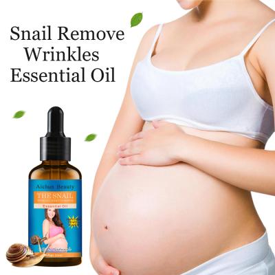 China Stretch mark remove brand organic pure anti prevention essential oil body oil essential oil removal laebl laebl private stretch mark oil for sale