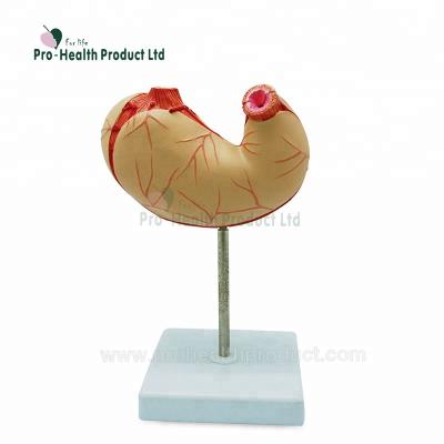 China PVC+ABS Medical Anatomy Human Stomach Model for sale