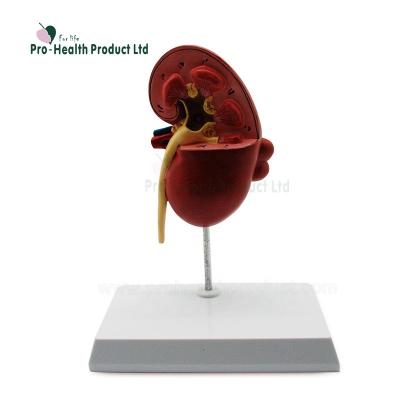 China PVC+ABS Disease Kidney Anatomy Medical Educational Model Of Human for sale