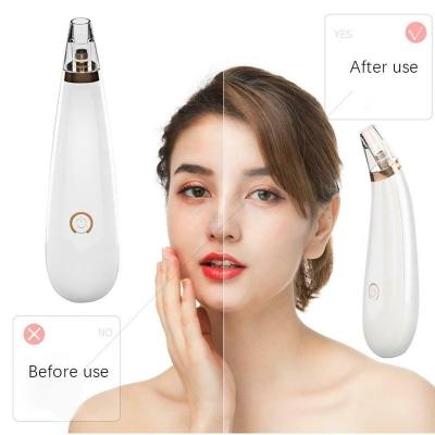 China 2022 Acne Treatment Blackhead Remover Pore Vacuum Suction Remover Upgraded Strong Vacuum Strong Suction Blackhead Acne Removal Facial Extractor Tool Kit for sale