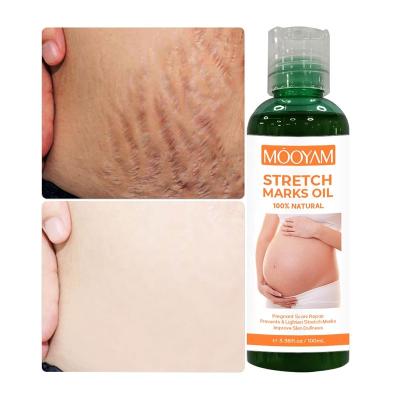 China Strong Effective Skin Revitalizer Stretch Mark Removal Oil Scar Remover Body Pregnancy Skin Repair Tightening Stretch Marks Oil for sale