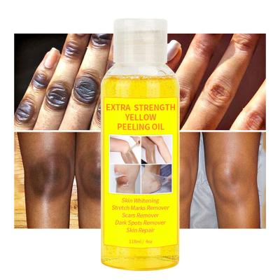 China Skin Revitalizer Super Strength Yellow Skin Oil Brighten Elbows Knees Hands Melanin Whitening Dark Skin Strong Skin Oil for sale