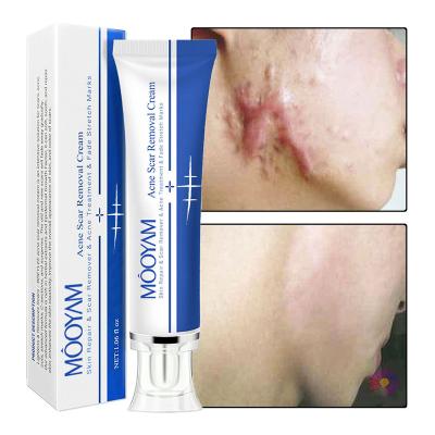 China Effective Skin Revitalizer Scar Removal Face Cream Acne Pimples Stretch Marks Remove Anti Stretch Mark Firming Smoothing Gel Marks Repair Cream for sale