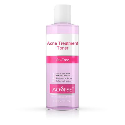 China Brightening Toner Private Label Acne Treatment Acne Body Spray Acne Toner for sale