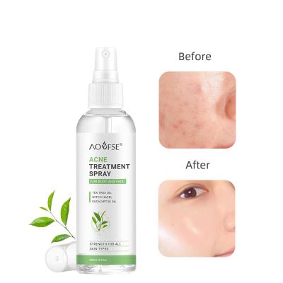 China Private Label Acne Remover Toner Moisturizing Acne Toner Body Acne Brightening Spray for sale