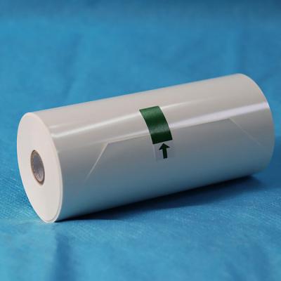 China High Glossy V Type Ultrasound Printer Paper Roll Medical Ultrasound Heat Sensitive Paper for sale