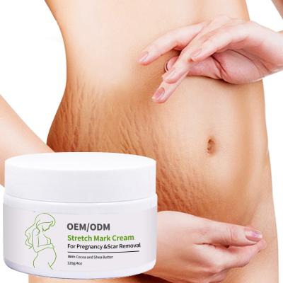 China Mark Cream Serum Body Cream Hydrates Non-Greasy Skin Revitalizer Skin Care Extent Body Cream for Scars and Stretch Marks for sale