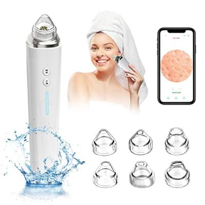 China Electric Visible Blackhead Remover WIFI Blackhead Remover Pore Remover Suction Remover Black Head Nose Deep Facial Skin Care Electric Visible Vacuum With Camera for sale