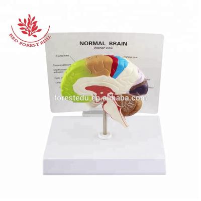 China Medical Educational Model Anatomical Model (Color to Divide) Brain Function Model Supply Human Brain Anatomy for sale