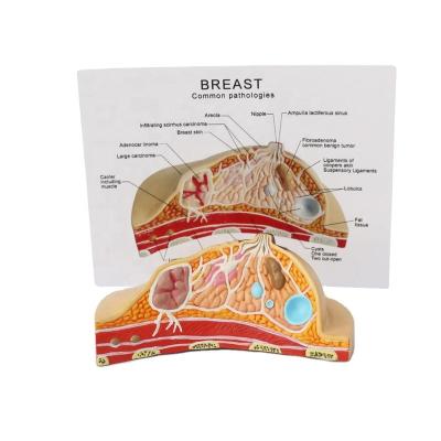 China Medical Educational Anatomical 1:1 Supply Mid Section Of Human Female Model Models Table Type Breast Pathology Anatomy Kit For Medical Education for sale