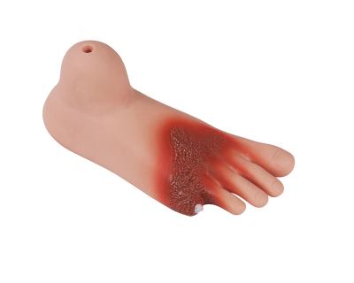 China School Teaching Model Diabetes Foot Model for sale