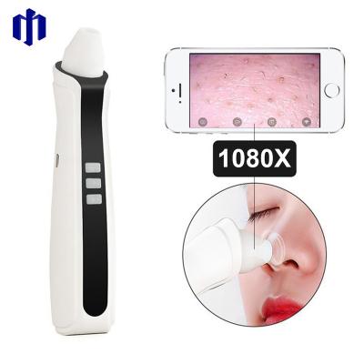 China Blackhead and Pore DEEP CLEANING Cleanser Device, Electric Blackhead Removal Machine for sale