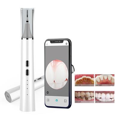 China Portable Handheld Ultrasonic Tooth Cleaner with Built-in HD Camera Removes Tooth Stains, Plaque, and Dental Calculus for sale