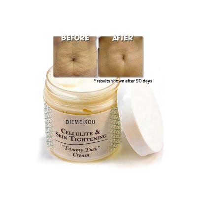 China Natural Skin Revitalizer Best Private Label Stretch Mark Cream For Pregnancy And Scar Removal Stretch Marks Mark Removal Cream Maternity Treatment for sale