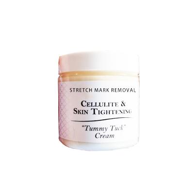 China Skin Revitalizer Mango Stretch Mark Cream For Pregnancy Repair Mark Loose Line Abdomen Stretch Marks Cream for sale