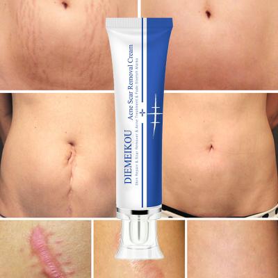 China Skin Revitalizer OEM Acne Scar Removal Cream Body Pregnancy Skin Repair Stretch Marks Whitening Cream for sale