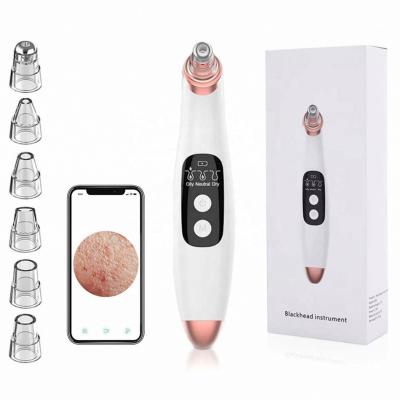 China Hot Sale Blackhead Remover Vacuum Pore Remover Blackhead Remover Acne Treatment Blackhead Remover For Nose And Face for sale