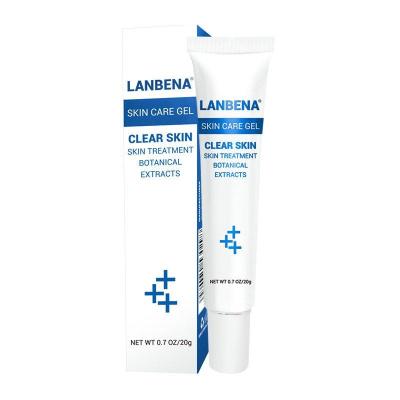 China LANBENA SKIN CARE GEL -prevent pimple and made marks fade for sale