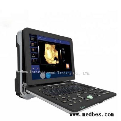 China Hot Color Doppler Ultrasound Diagnosis System for sale