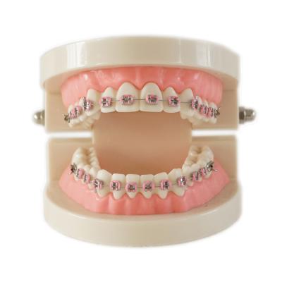 China Dental Teeth Teaching Study Model Set Orthodontic Model with Metal Bracket /dental bracket Standard model of dentures en venta