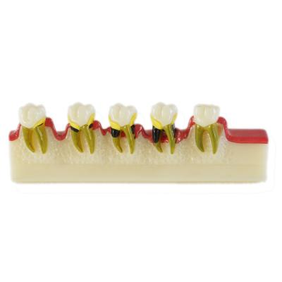 Китай Dental Caries Developing model / Dental Medical Teeth Teaching Model продается