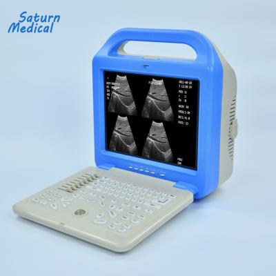 China 32 pictures manufacture price lcd laptop portable ultrasound machine for sale