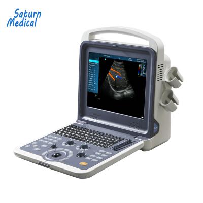 China Portable Color Doppler Ultrasound Scanner With CE S0 for sale