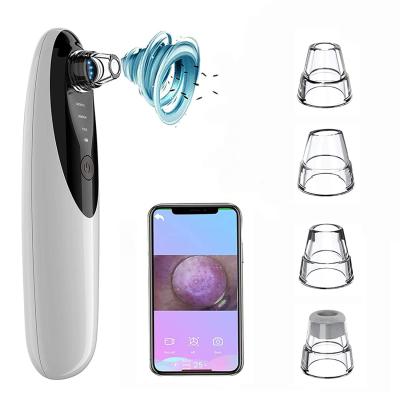 China Electric Acne Treatment Blackhead Instrument Suction Vacuum Blackhead Remover Vacuum With Camera for sale