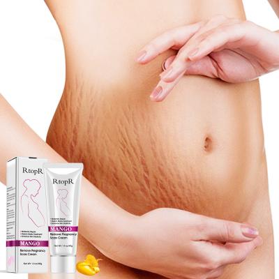 China Weight Loss Private Label Mango Stretch Mark Cream For Pregnancy Repair Mark Loose Line Abdomen Stretch Marks Removal Cream for sale