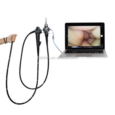 China New Type Cheap Medical Flexible USB Endoscope HD USB Gastroenterology LHEMV2 Portable Video Gastroscope High Resolution for sale