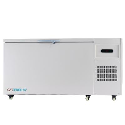 China Single-temperature factory hot sale minus 65 - to 86 degree celsius ultra low chest freezer for sale