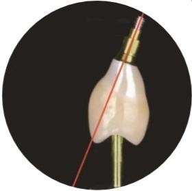 China El ASC natural pescó el canal del tornillo con caña que los implantes dentales coronan en venta