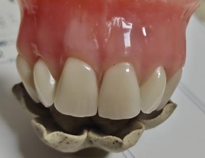 China Dentadura parcial de acrílico curada fría de la dentadura llena de la estética en venta