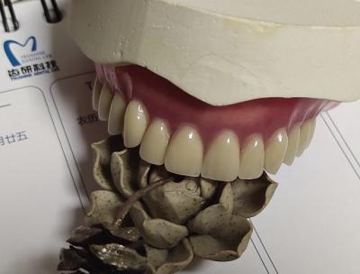 China Dentadura parcial de acrílico de la estética permanente completa de la dentadura en venta