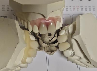 Китай Удобный Denture пригонки ISO13485 RPD мягкий невидимый продается