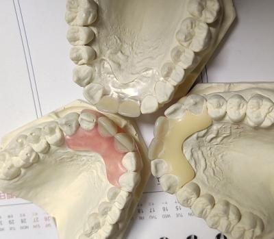 Китай Denture металла смолы свободный невидимый для аллергического пациента продается