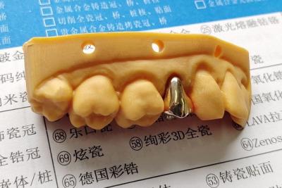 China Corona dental del alto metal lleno noble del oro en venta