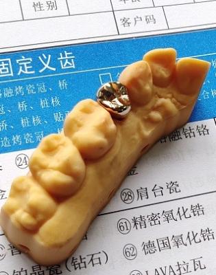 China Alta corona dental preciosa de la aleación de oro de la buena aptitud en venta